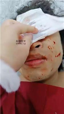 广西木木可爱女主-强制舔卫生巾/骑狗背 JS250107-28