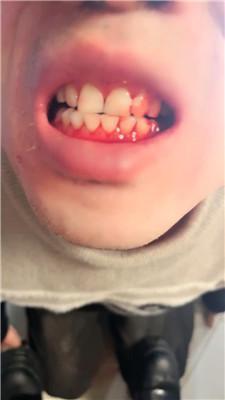 语阳连环抽耳光狂抽 JS250116-12