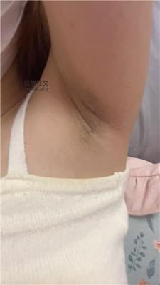 兔牙进来给妈妈做腋下管理 250212-20