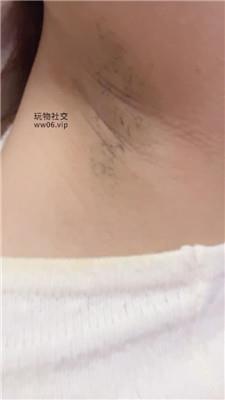 兔牙进来给妈妈做腋下管理 250212-20