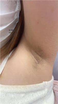 兔牙进来给妈妈做腋下管理 250212-20