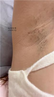 兔牙进来给妈妈做腋下管理 250212-20