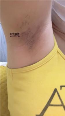 兔牙这是你心心念念的腋下吗 250226-20
