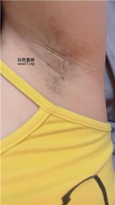 兔牙这是你心心念念的腋下吗 250226-20