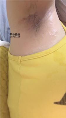 兔牙这是你心心念念的腋下吗 250226-20