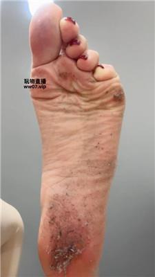 酒鸽脏脚底 250312-6