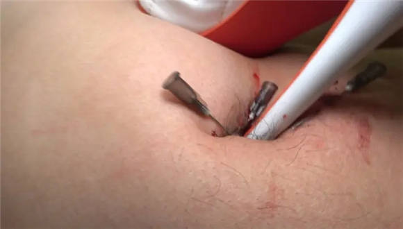 【冷柔】超残忍虐乳足控资源网|爱秀美图