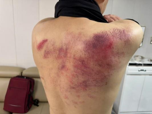 【爱秀套图】『chnnsct1818』jk圈踹鞋印残忍跺手 YC-250419-3