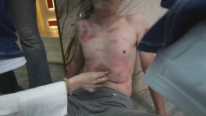 【爱秀套图】群s粗烟重烫狗烤肉 体无完肤 跆拳道悬踢头脚脚昏厥 YC-250529-5