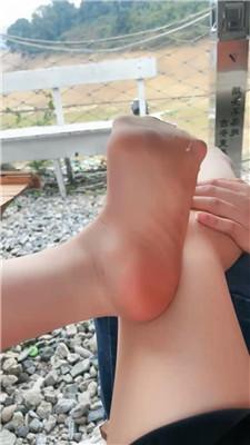 漫音户外肉丝脚诱惑抖M  JS241109-18