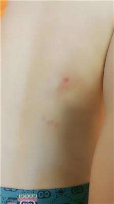 大庆肇州重度掐肉专场完整版 JS241119-24