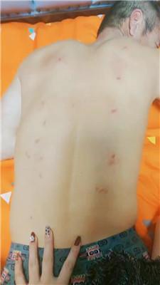 大庆肇州重度掐肉专场完整版 JS241119-24