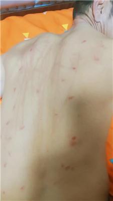 大庆肇州重度掐肉专场完整版 JS241119-24