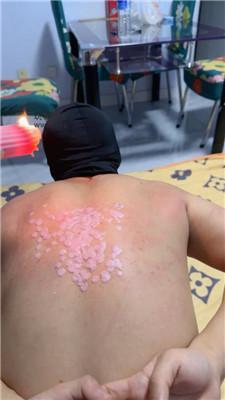 曦颜重度虐乳强制滴蜡 JS250114-16