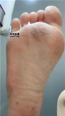 酒鸽脏脚底    250312-6