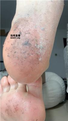 酒鸽脏脚底    250312-6